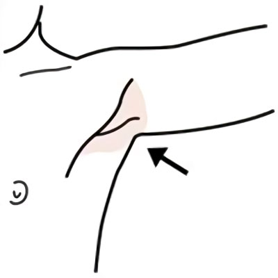 AXILA